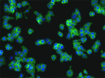 Cancer Nanotechnology